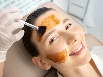 Cosmelan Peel